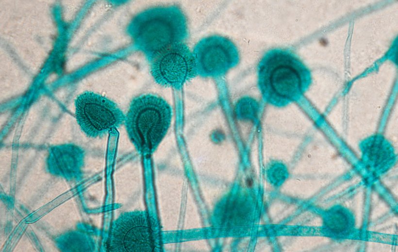 Aspergillus fungus under the microscope