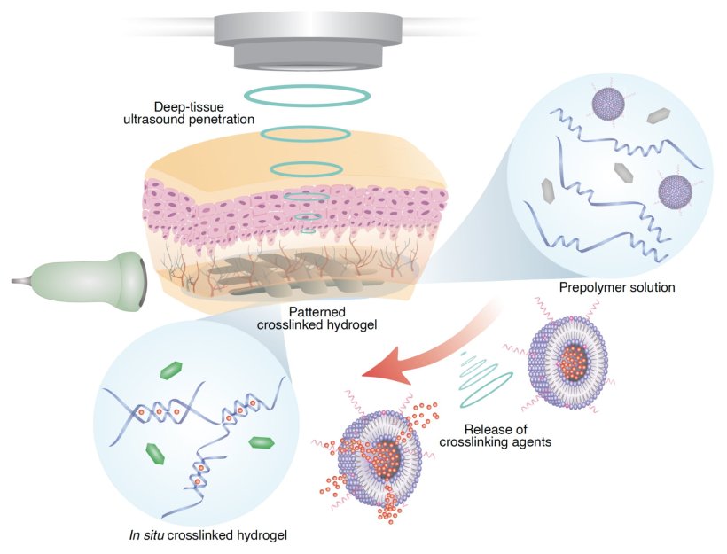 The deep tissue in vivo sound printing (DISP) platform. The technique combines...