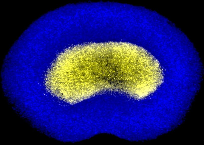 Stereoscopic images of fluorescent cell tracker dyes showing the distribution...