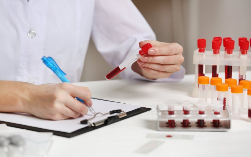 A female laboratory worker is checking blood samples and taking notes on a...