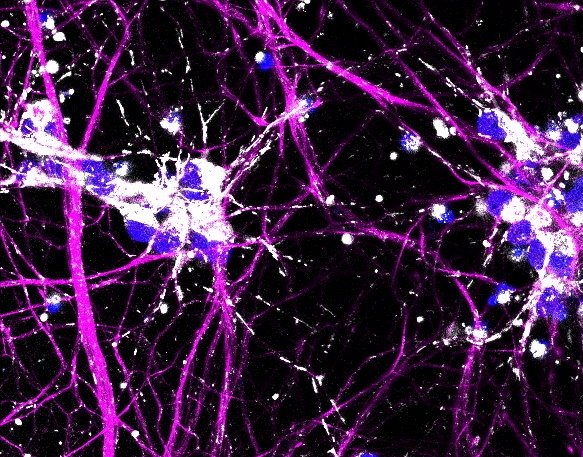 Purple neurons with mitochondria