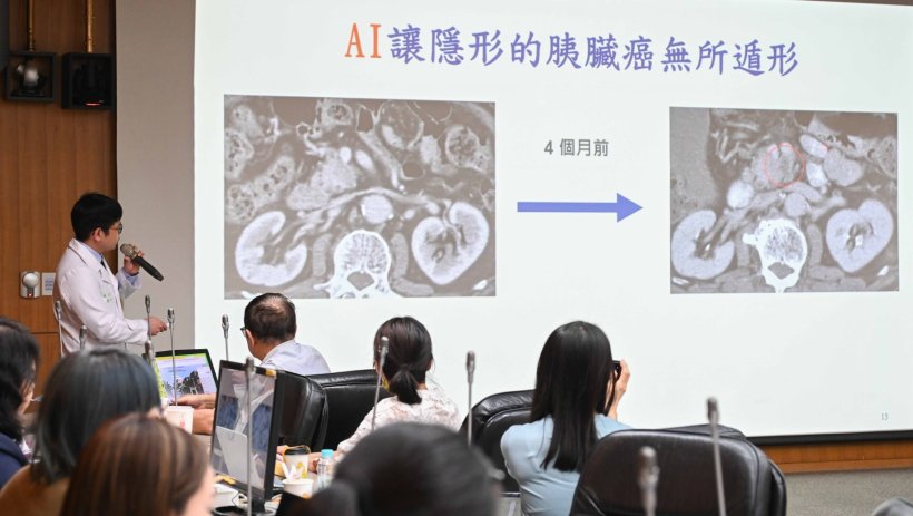 Dr Po-Ting Chen presents the new “PANCREASaver” AI system