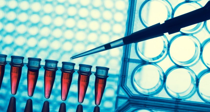 Pipette and vials with blood in a laboratory