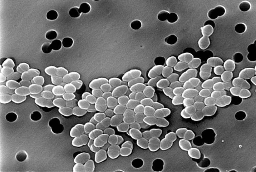 Vancomycin resistant Enterococcus bacteria under the microscope