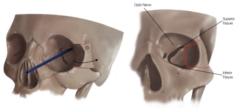 Four partial 3D illustration of human skulls, showing the details of a complex...