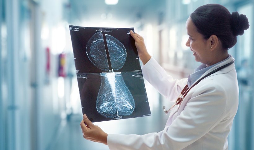 A doctor is examining mammography scans of her patient
