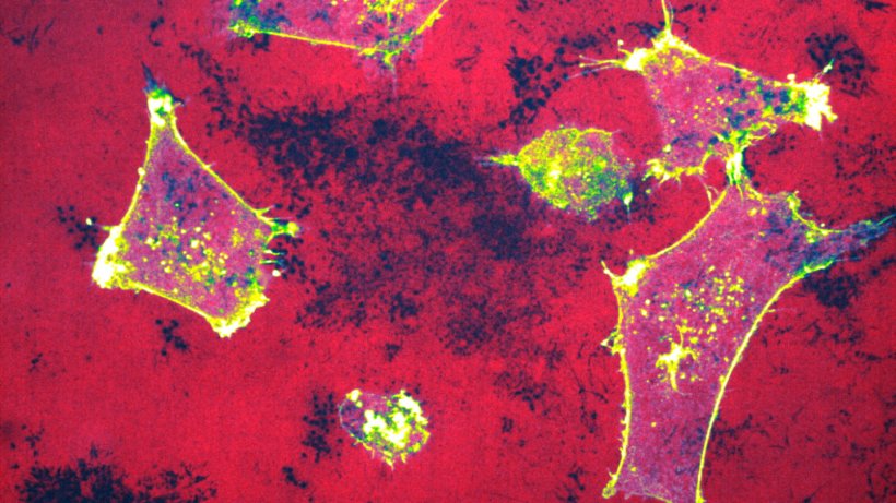 Red microscopy image of breast cancer cells