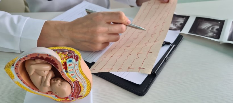 A cardiologist is checking the ECG readout from an unborn baby on his desk. In...