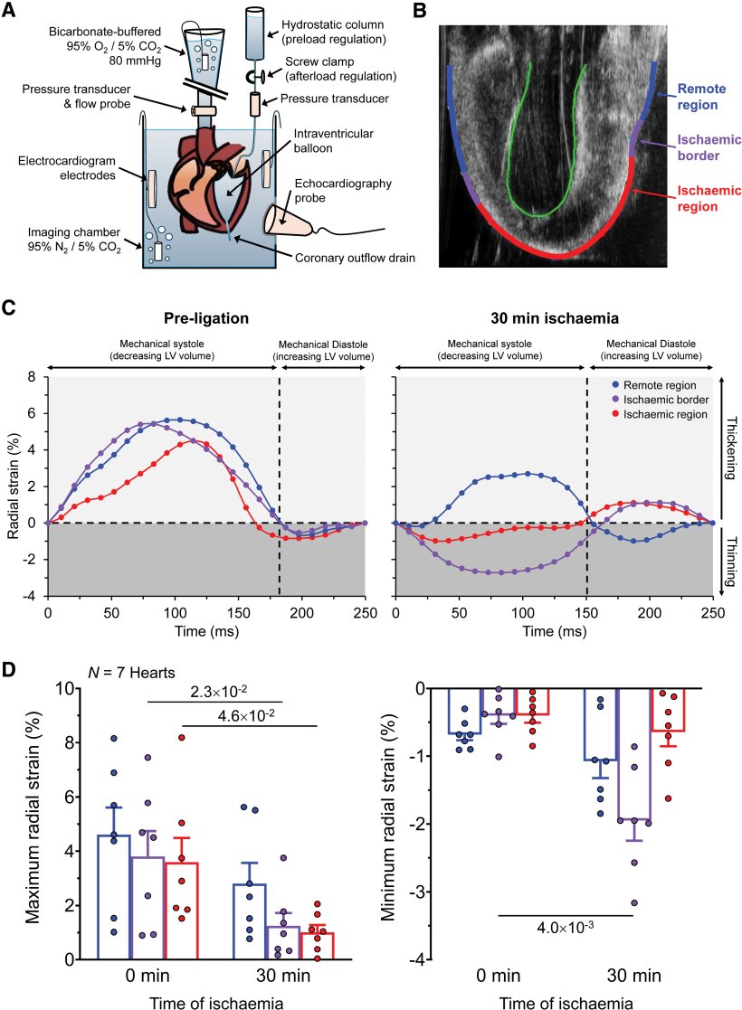 Figure 1. Altered left ventricular (LV) mechanical activity during acute...