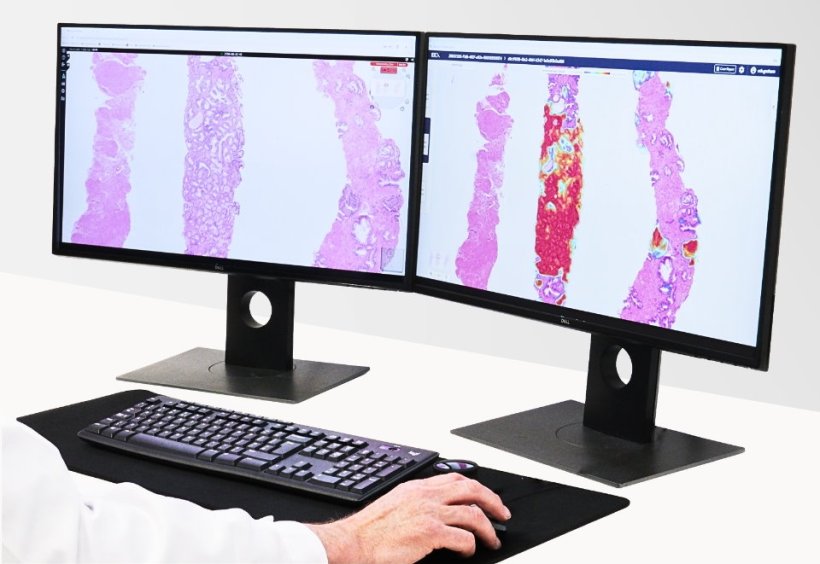 A dual-monitor setup with digital pathology images displayed