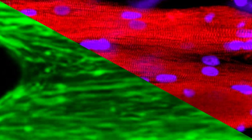 Green and red image of muscle tissue