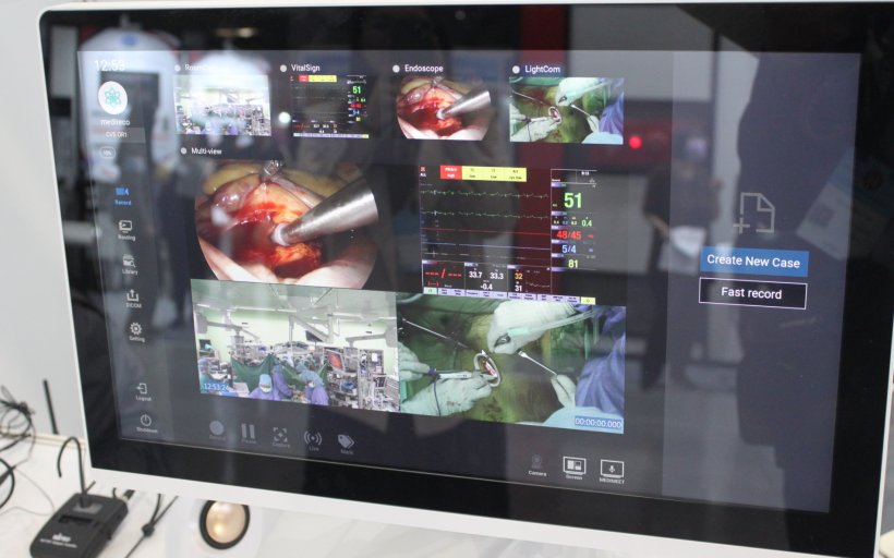 A computer monitor showing a multi-view image of a medical procedure