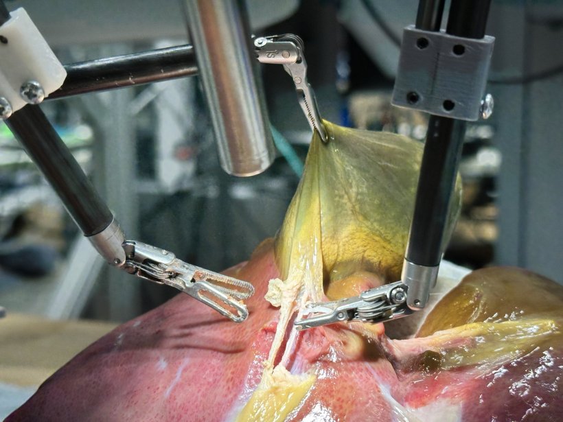 Robotic surgery performed on a realistic model of a gallbladder