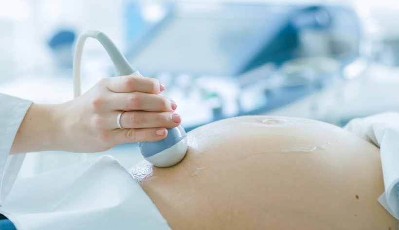Eine Ärztin untersucht eine schwangere Patientin per Ultraschall. Die Sonde...