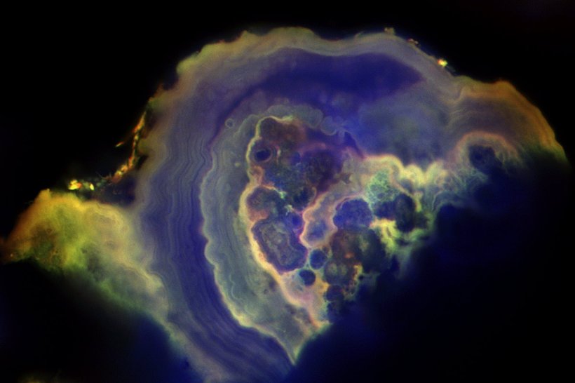 Cross-section of a breast calcification
