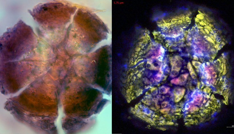 Two cracked disks, left of petrified wood, right of breast calcification
