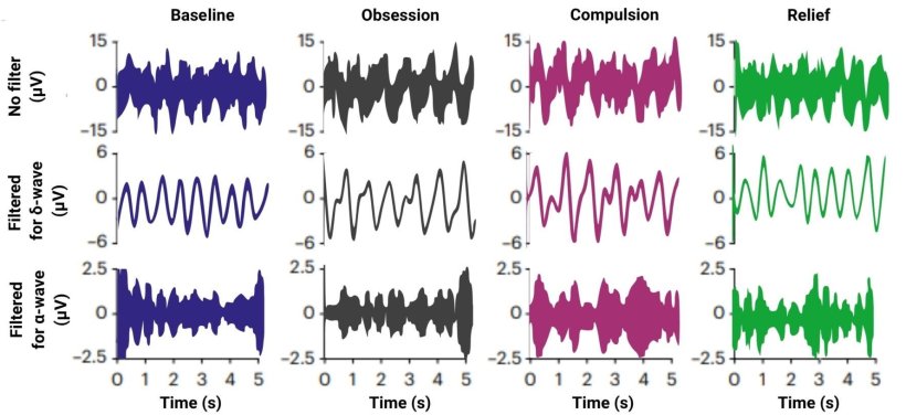 Arrangement of several brain wave graphs in various colors