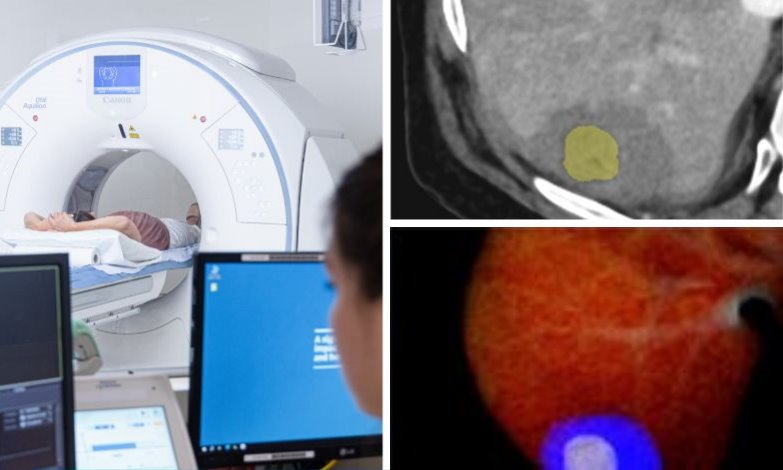 In the left half, a patient is undergoing a CT scan. The right half consists of...