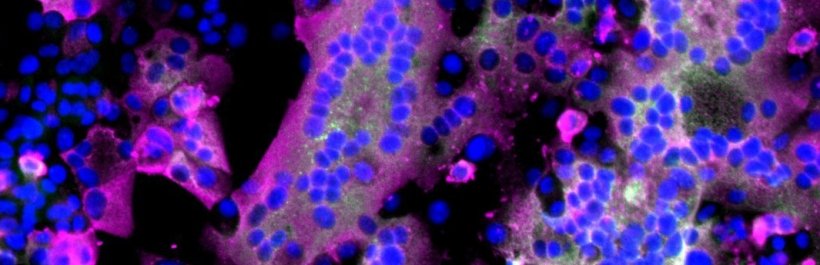 Immunofluorescence staining of cells infected with SARS-CoV-2 isolated from the...