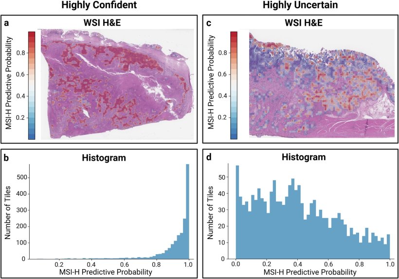 a, c: Whole-slide images (WSIs) with tile-level microsatellite instability-high...
