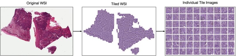 Self-learning AI: a boost for digital pathology