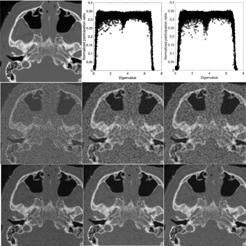 Medical MRI images arranged in a 3 by 3 grid, with various levels of noise...