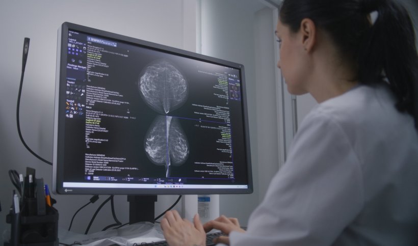 A female doctor is looking at mammography images of a patients breasts on a...