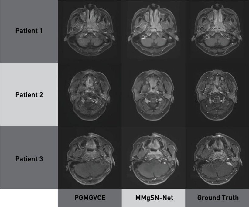 Nine MRI brain scans arranged in a 3x3 grid