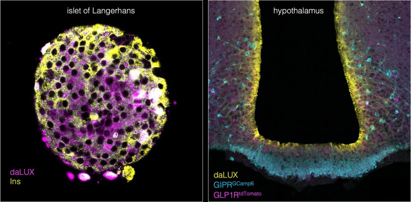 daLUXendine können mithilfe der Fluoreszenzmikroskopie sichtbar gemacht...