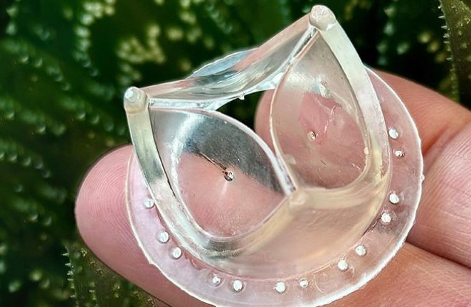 An artificial heart valve made from transparent plastic, held by two fingers