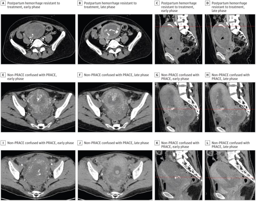 Evaluation of dynamic Computed Tomography (CT) images: A-D, Representative case...