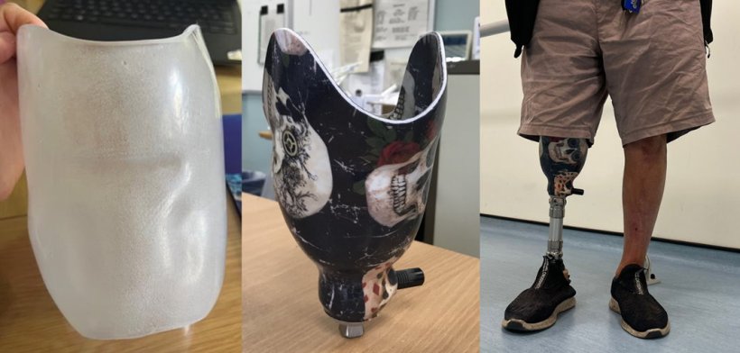 Three images showing the process of designing a prosthetic leg, from a basic...