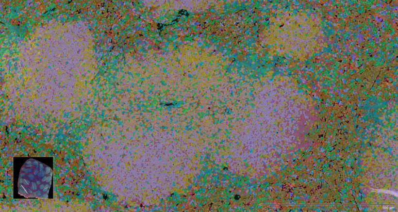 Maus-Milz: Xenium-In-situ-Transkriptomik der Mausmilz zeigt die...
