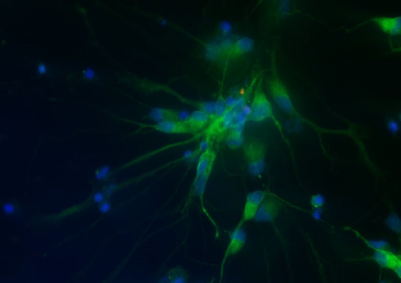 Repräsentatives Immunfluoreszenzbild, das die neuroprotektive Wirkung des...