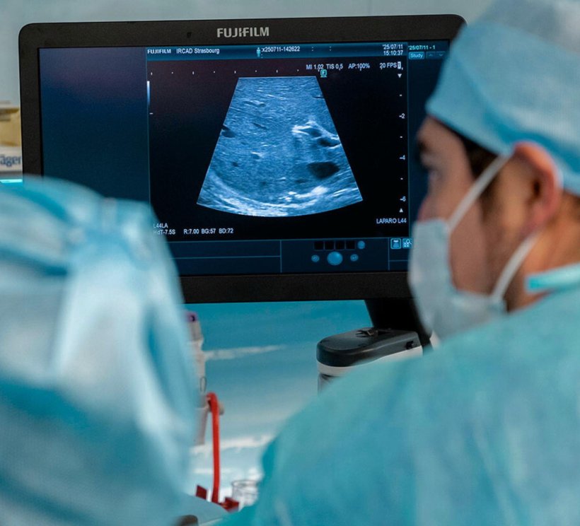 Over-the-shoulder view of two surgeons looking at an sonography image on a...