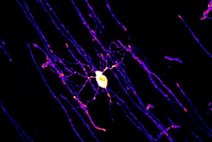Reifer, myelinbildender Oligodendrozyt aus dem Cingulate Cortex einer 5 Monate...