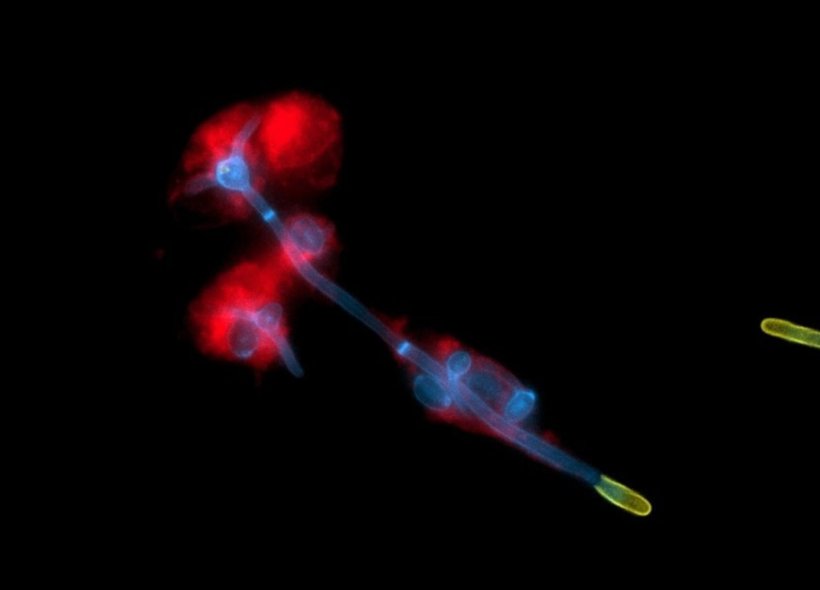 Mikroskopische Aufnahme vom Hefepilz Candida albicans