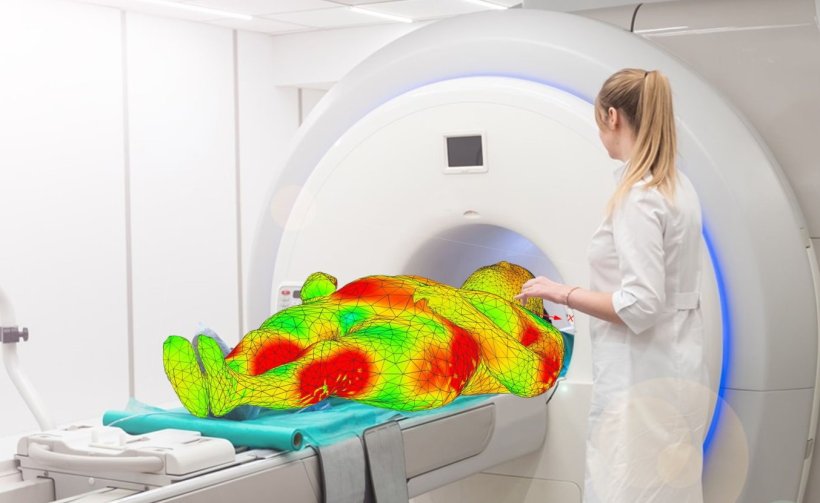 Ein polygonales 3D-Modell eines Patienten liegt in einem MRT-Scanner. Das...