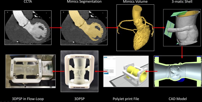 Workflow from CCTA-based creation of the 3D–printed patient-specific phantom...