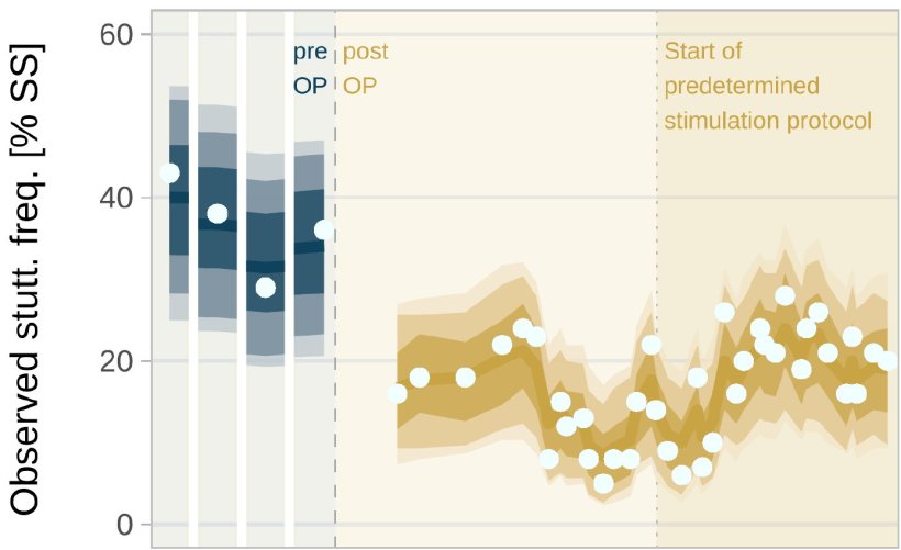 Ein Diagramm, das die Intensität des Stotterns bei einem Patienten vor und...