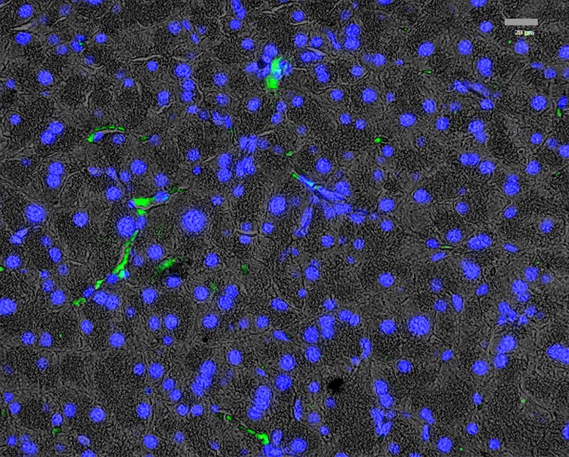 Immunfluoreszenz-Bildgebung der Expression des Platelet-derived growth factor...