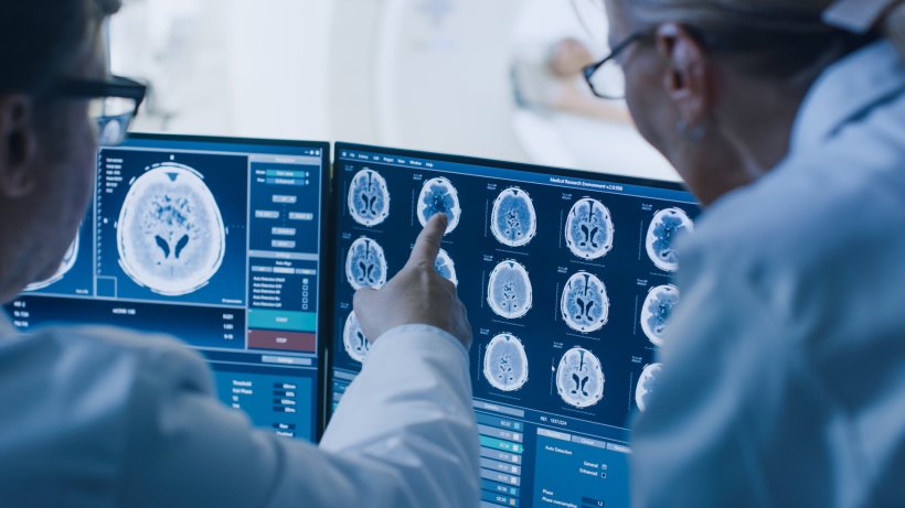Zwei Radiologen sehen sich MRT-Hirnscans auf einem Computermonitor an. Der Mann...