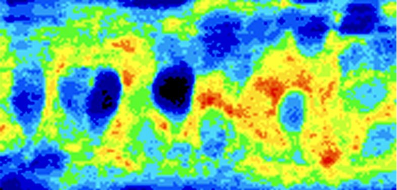 Highly degradative (dark) cells in the spinal cord were identified as motor...