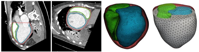 Das Forschungsteam nutzte echte MRT-Daten (links), um eine digitale Simulation...