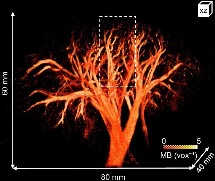 3D microbubbles (MB) density map of an in-vivo porcine kidney showing the size...