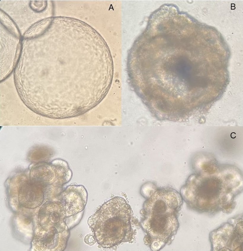 Beispielhafte mikroskopische Aufnahmen patientenspezifischer Organoidkulturen,...