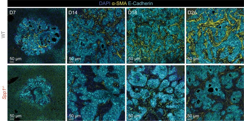 Differences in the tumour microenvironment of animals lacking osteopontin...