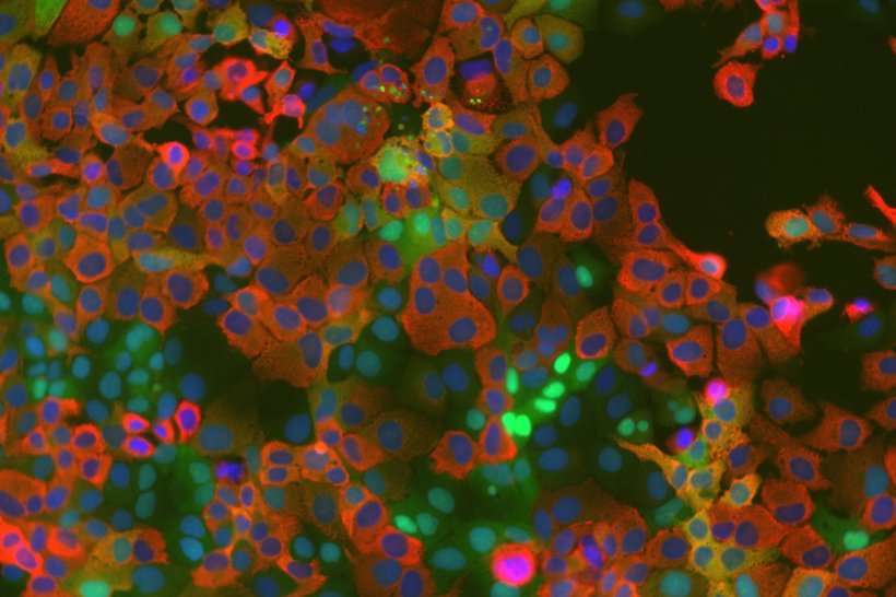 Zellkulturzellen, die einen Kinase-Aktivitätstreporter exprimieren (grün)...