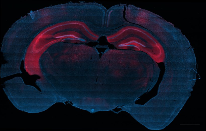 Brain section demonstrating high spatial resolution gene expression achieved...