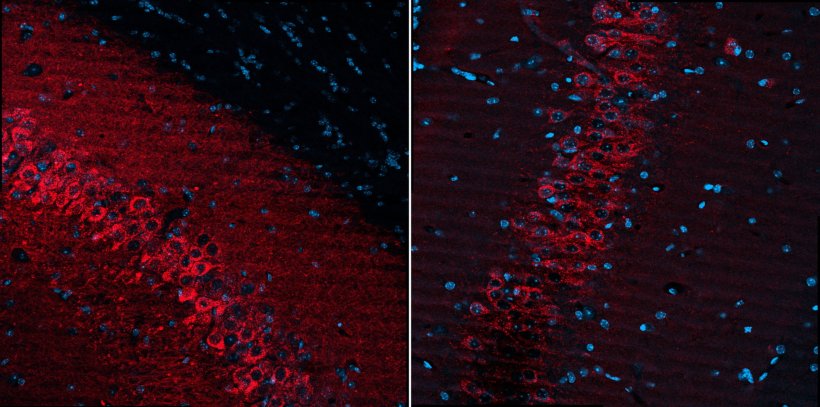 Two magnified images of hippocampus regions showing high transduction...